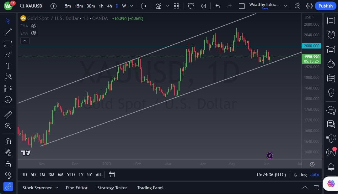 Gráfico del Pronóstico Oro Hoy