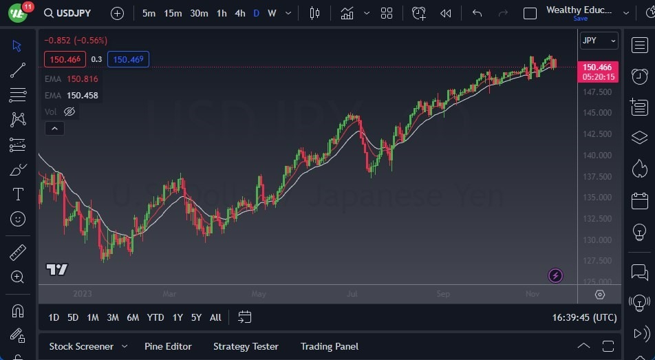 Gráfico del Pronóstico USD/JPY Gráfico del Pronóstico USD/JPY