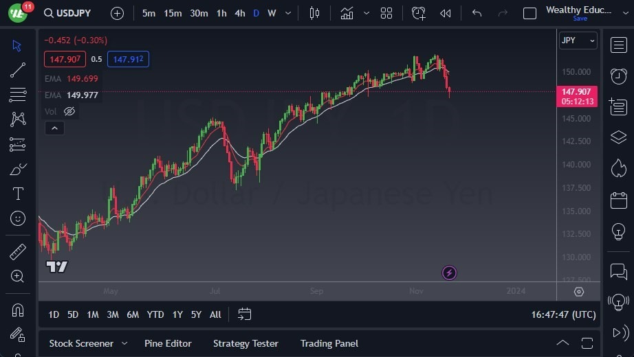 Gráfico del Pronóstico USD/JPY Gráfico del Pronóstico USD/JPY